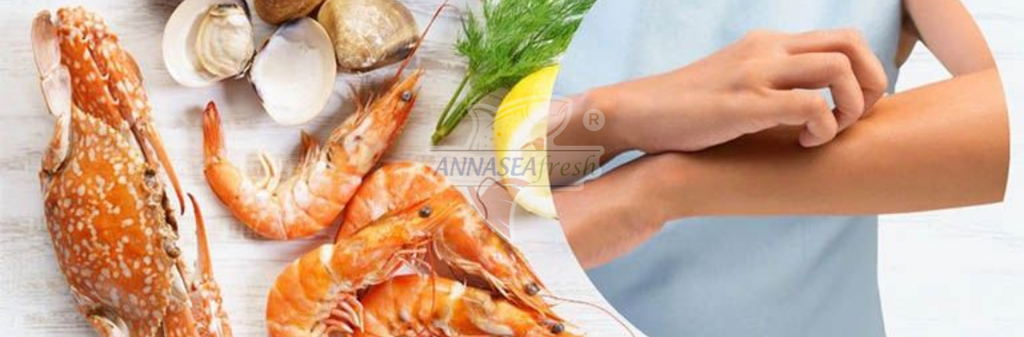 DẤU HIỆU NHẬN BIẾT VÀ CÁCH PHÒNG TRÁNH DỊ ỨNG HẢI SẢn