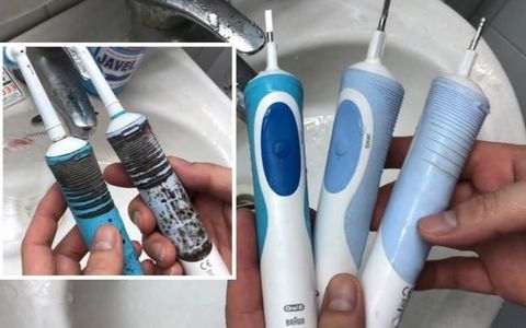 Bàn Chải Điện Bị Mốc: Nguyên Nhân Và Cách Xử Lý Hiệu Quả