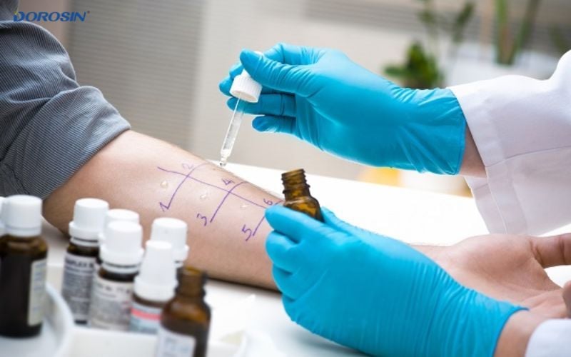 cách chữa dị ứng thời tiết 3