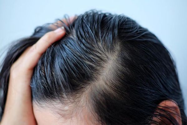 Cách giúp tóc mọc dày trở lại và trông dày hơn tự nhiên