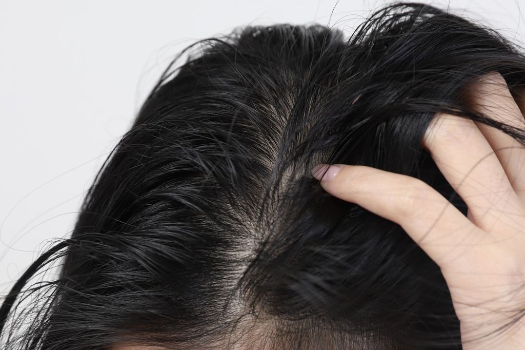 Nhiều người tóc bết dù gội đầu rất thường xuyên