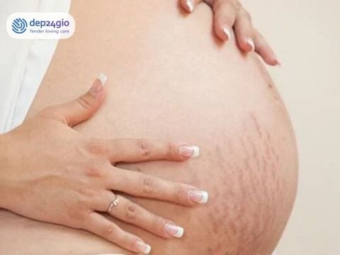 Kem Chống Rạn Cho Bà Bầu Tốt Nhất: Top 5 An Toàn Cho Mẹ Và Bé