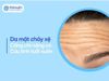 Khắc phục da mặt chảy xệ với công nghệ chuẩn y khoa