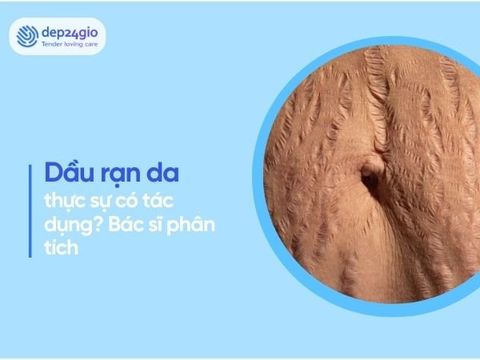 Dầu rạn da có tác dụng không? Bác sĩ phân tích