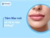 Filler môi: An toàn hay tiềm ẩn rủi ro? Những điều cần biết