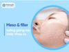 Meso và filler: Hai kỹ thuật trẻ hóa tưởng giống mà khác xa!