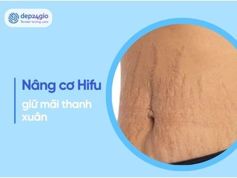 Khám phá bí quyết nâng cơ Hifu – Giữ mãi nét thanh xuân