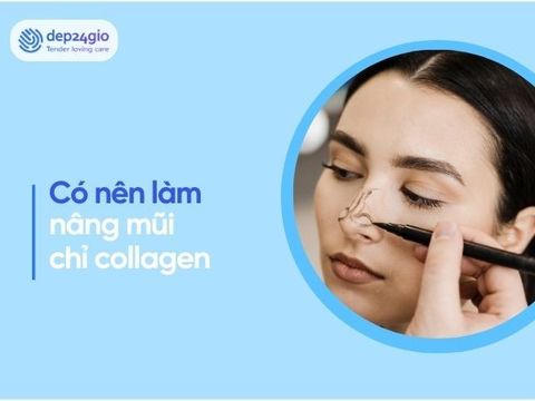 Nâng mũi chỉ collagen: Có nên thực hiện không?