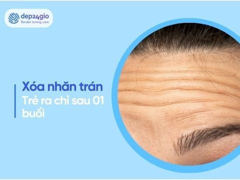 Xóa nhăn trán bằng Botox – Trẻ hơn 5 tuổi chỉ sau 1 buổi