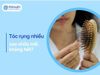 Tóc rụng nhiều – Vì sao chữa tự nhiên không hiệu quả?