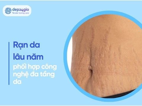 Công nghệ mới trị rạn da lâu năm – Hiệu quả gấp 3 lần