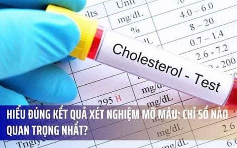 Hiểu Đúng Kết Quả Xét Nghiệm Mỡ Máu: Chỉ Số Nào Quan Trọng Nhất?