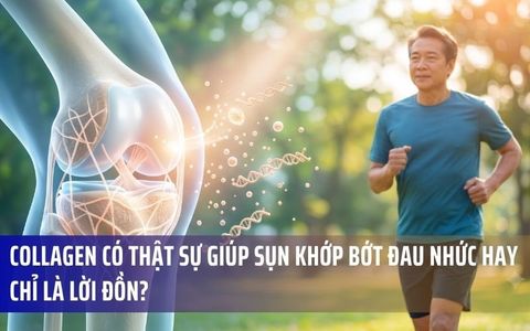 Collagen Có Thật Sự Giúp Sụn Khớp Bớt Đau Nhức Hay Chỉ Là Lời Đồn?