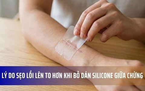 Lý Do Sẹo Lồi Lên To Hơn Khi Bỏ Dán Silicone Giữa Chừng