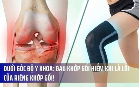 Dưới Góc Độ Y Khoa: Đau Khớp Gối Hiếm Khi Là Lỗi Của Riêng Khớp Gối!