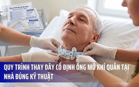 Quy Trình Thay Dây Cố Định Ống Mở Khí Quản Tại Nhà Đúng Kỹ Thuật