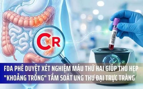 FDA Phê Duyệt Xét Nghiệm Máu Thứ Hai Giúp Thu Hẹp 