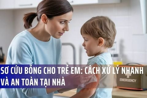 Sơ cứu bỏng cho trẻ em: Cách xử lý nhanh và an toàn tại nhà