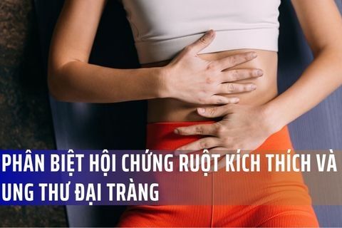 Phân Biệt Hội Chứng Ruột Kích Thích Và Ung Thư Đại Tràng