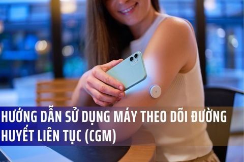 Hướng dẫn sử dụng máy theo dõi đường huyết liên tục (CGM) từ chuyên gia