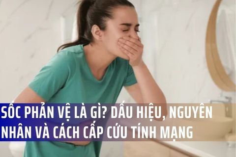 Sốc Phản Vệ Là Gì? Dấu Hiệu, Nguyên Nhân Và Cách Cấp Cứu Tính Mạng