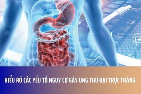 Hiểu Rõ Các Yếu Tố Nguy Cơ Gây Ung Thư Đại Trực Tràng