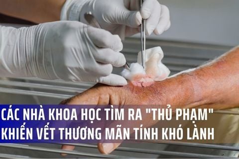 Các nhà khoa học tìm ra 
