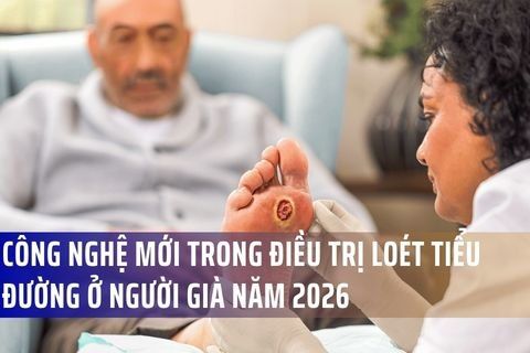 Công Nghệ Mới Trong Điều Trị Loét Tiểu Đường Ở Người Già Năm 2026