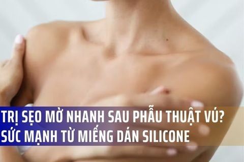 Làm Thế Nào Để Trị Sẹo Mờ Nhanh Sau Phẫu Thuật Vú? Sức Mạnh Từ Miếng Dán Silicone
