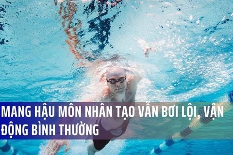 Mang hậu môn nhân tạo vẫn bơi lội, vận động bình thường – Giải đáp từ chuyên gia Việt Đức