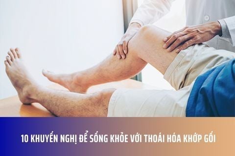 10 Khuyến Nghị Để Sống Khỏe Với Thoái Hóa Khớp Gối