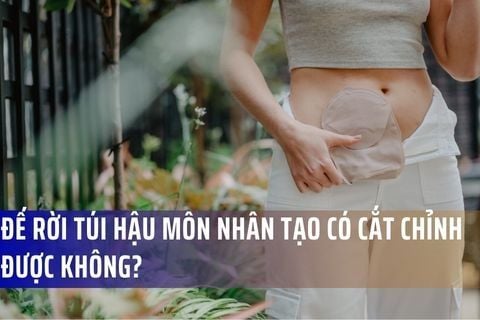 Đế rời túi hậu môn nhân tạo có cắt chỉnh được không?
