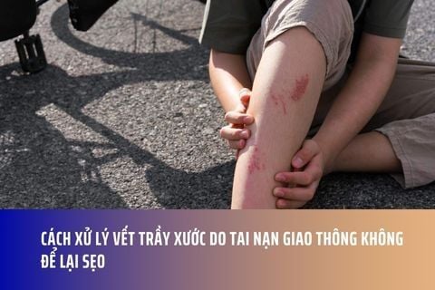 Cách Xử Lý Vết Trầy Xước Do Tai Nạn Giao Thông Không Để Lại Sẹo