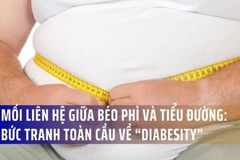 MỐI LIÊN HỆ GIỮA BÉO PHÌ VÀ TIỂU ĐƯỜNG: BỨC TRANH TOÀN CẦU VỀ “DIABESITY”