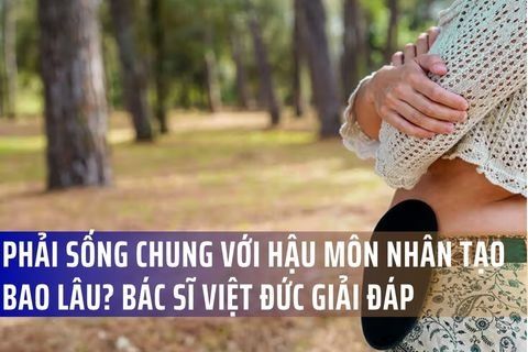 Phải sống chung với hậu môn nhân tạo bao lâu? Bác sĩ Việt Đức giải đáp chi tiết