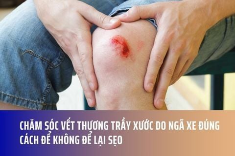 Chăm sóc vết thương trầy xước do ngã xe đúng cách để không để lại sẹo
