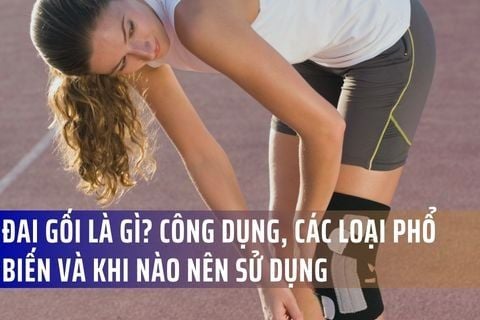 Đai Gối Là Gì? Công Dụng, Các Loại Phổ Biến Và Khi Nào Nên Sử Dụng