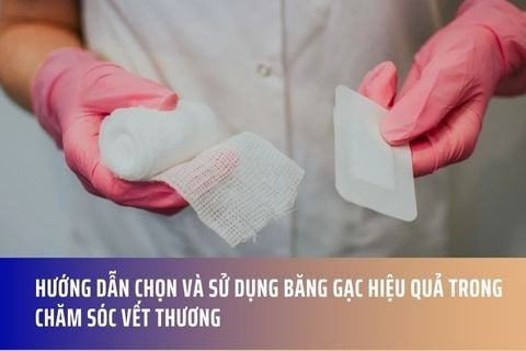 Hướng Dẫn Chọn Và Sử Dụng Băng Gạc Hiệu Quả Trong Chăm Sóc Vết Thương
