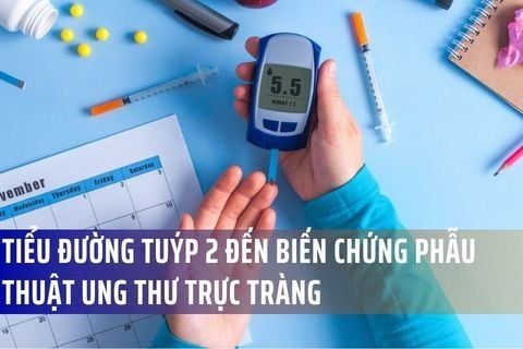 Ảnh Hưởng Của Tiểu Đường Tuýp 2 Đến Biến Chứng Phẫu Thuật Ung Thư Trực Tràng