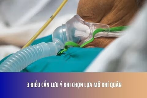 3 Điều Cần Lưu Ý Khi Chọn Lựa Mở Khí Quản