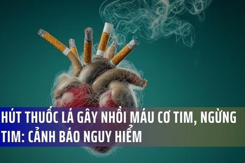 Hút Thuốc Lá Gây Nhồi Máu Cơ Tim, Ngừng Tim: Cảnh Báo Nguy Hiểm