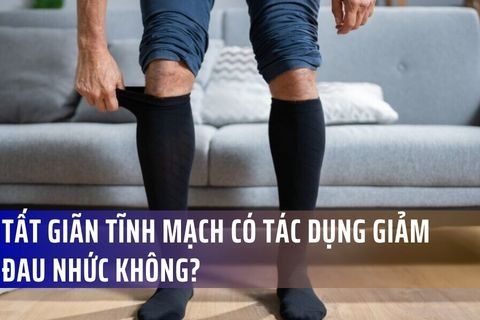 Tất giãn tĩnh mạch có tác dụng giảm đau nhức không?