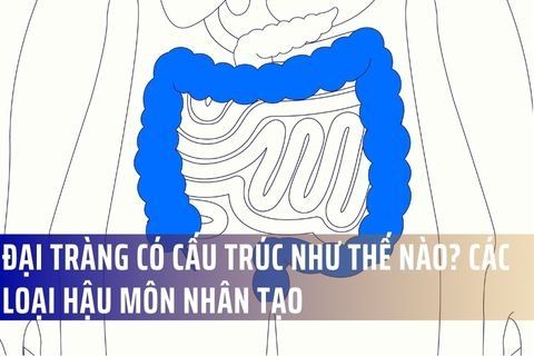 Đại tràng có cấu trúc như thế nào? Các loại hậu môn nhân tạo