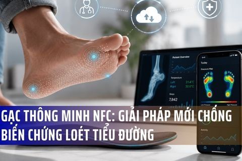Gạc Thông Minh NFC: Giải Pháp Mới Chống Lại Biến Chứng Loét Tiểu Đường Nguy Hiểm