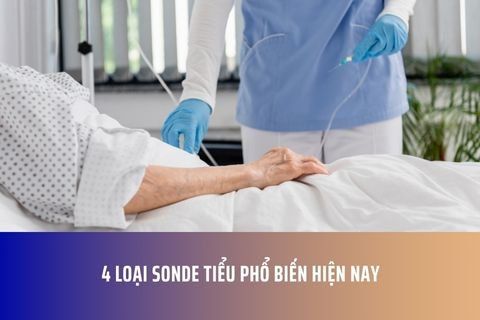 4 Loại sonde tiểu phổ biến hiện nay