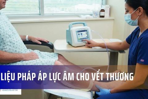 Liệu pháp áp lực âm cho vết thương