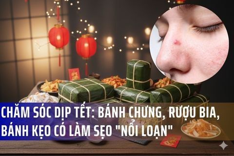 Chăm Sóc Sẹo Dịp Tết: Bánh chưng, Rượu Bia, Bánh Kẹo Có Làm Sẹo 