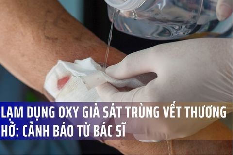 Lạm dụng oxy già sát trùng vết thương hở: Cảnh báo từ bác sĩ