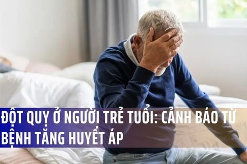 Đột quỵ ở người trẻ tuổi: Cảnh báo từ bệnh tăng huyết áp
