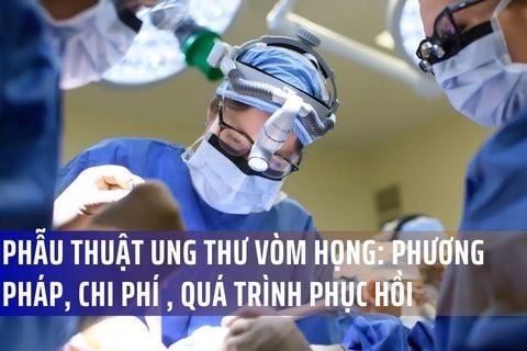 Phẫu Thuật Ung Thư Vòm Họng: Các Phương Pháp, Chi Phí Và Quá Trình Phục Hồi